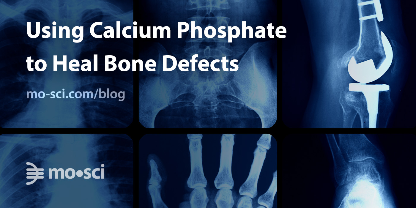 Using Calcium Phosphate to Heal Bone Defects MoSci Corporation