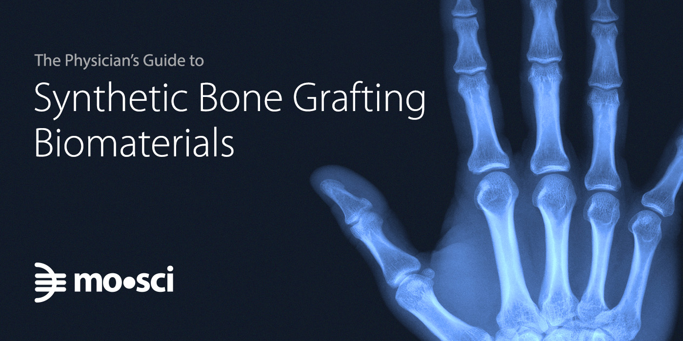 Physician S Guide To Synthetic Bone Grafting Biomaterials Mo Sci